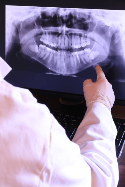 Best Emergency Tooth Extraction in Sanford, ME